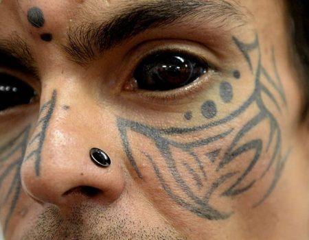 Most people have heard of tattooing the cornea before for health reasons.