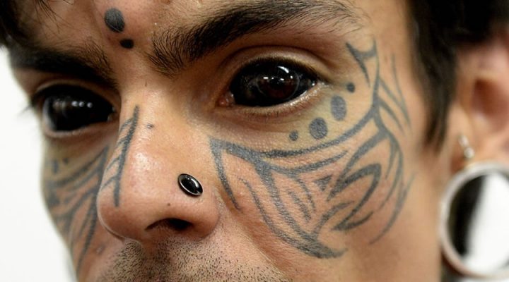 Most people have heard of tattooing the cornea before for health reasons.