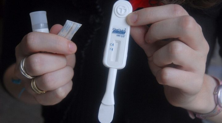 HIV Testing – All That You Should Know About It