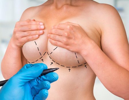 Cost of Breast Aesthetics in Turkey