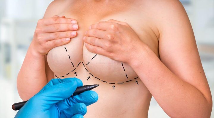 Cost of Breast Aesthetics in Turkey